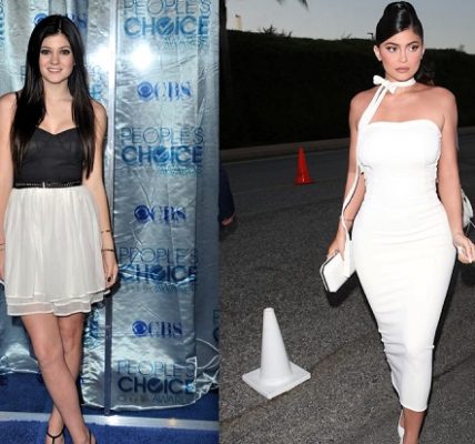 Kylie Jenner 2010 vs Kylie Jenner 2019, plastic surgeons belive she has been under the knife