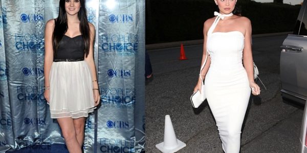 Kylie Jenner 2010 vs Kylie Jenner 2019, plastic surgeons belive she has been under the knife